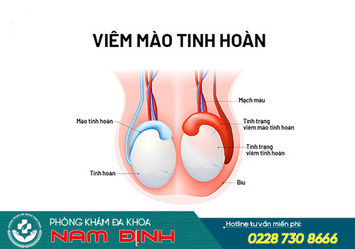 bệnh tinh hoàn